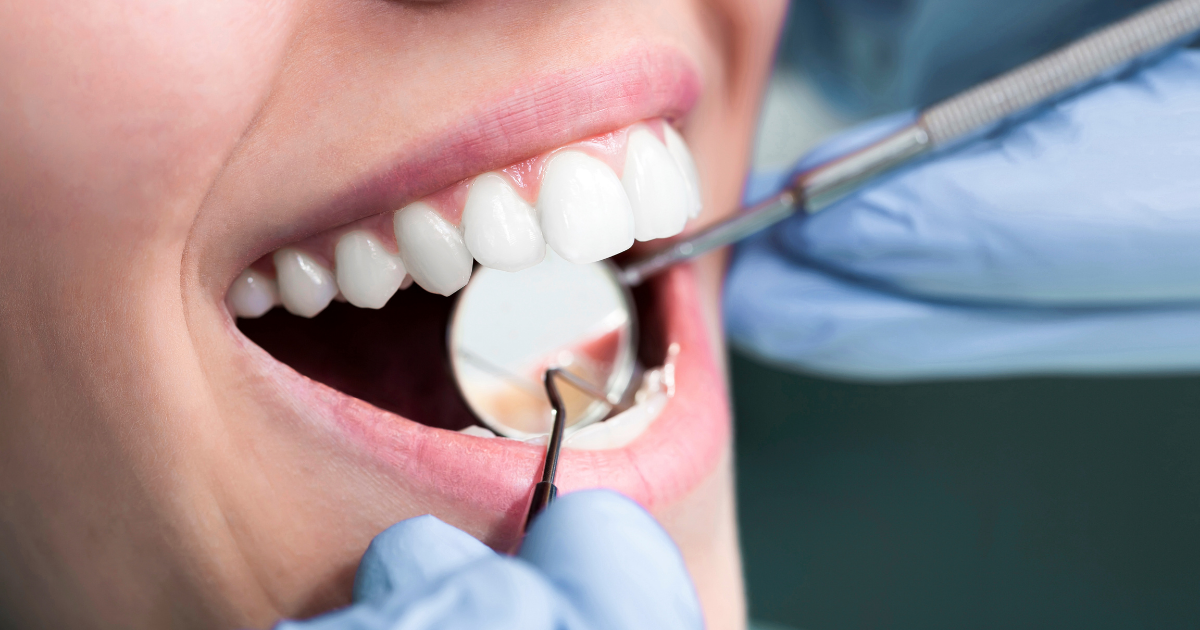 Close up of dentist examining a patient's smile