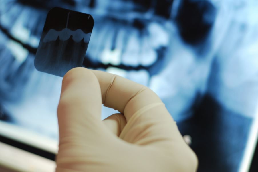 Dental X-rays