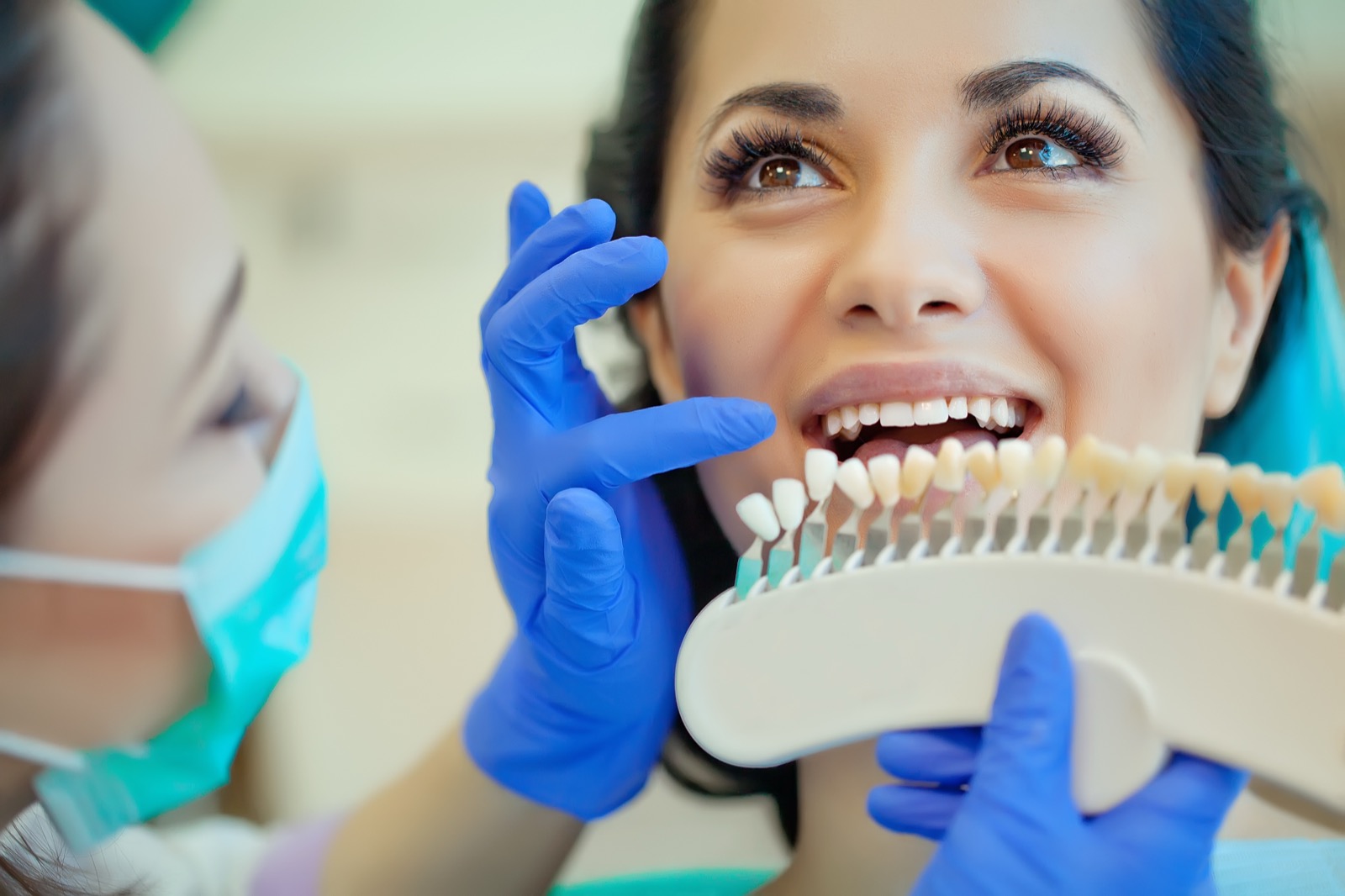 Porcelain dental veneers