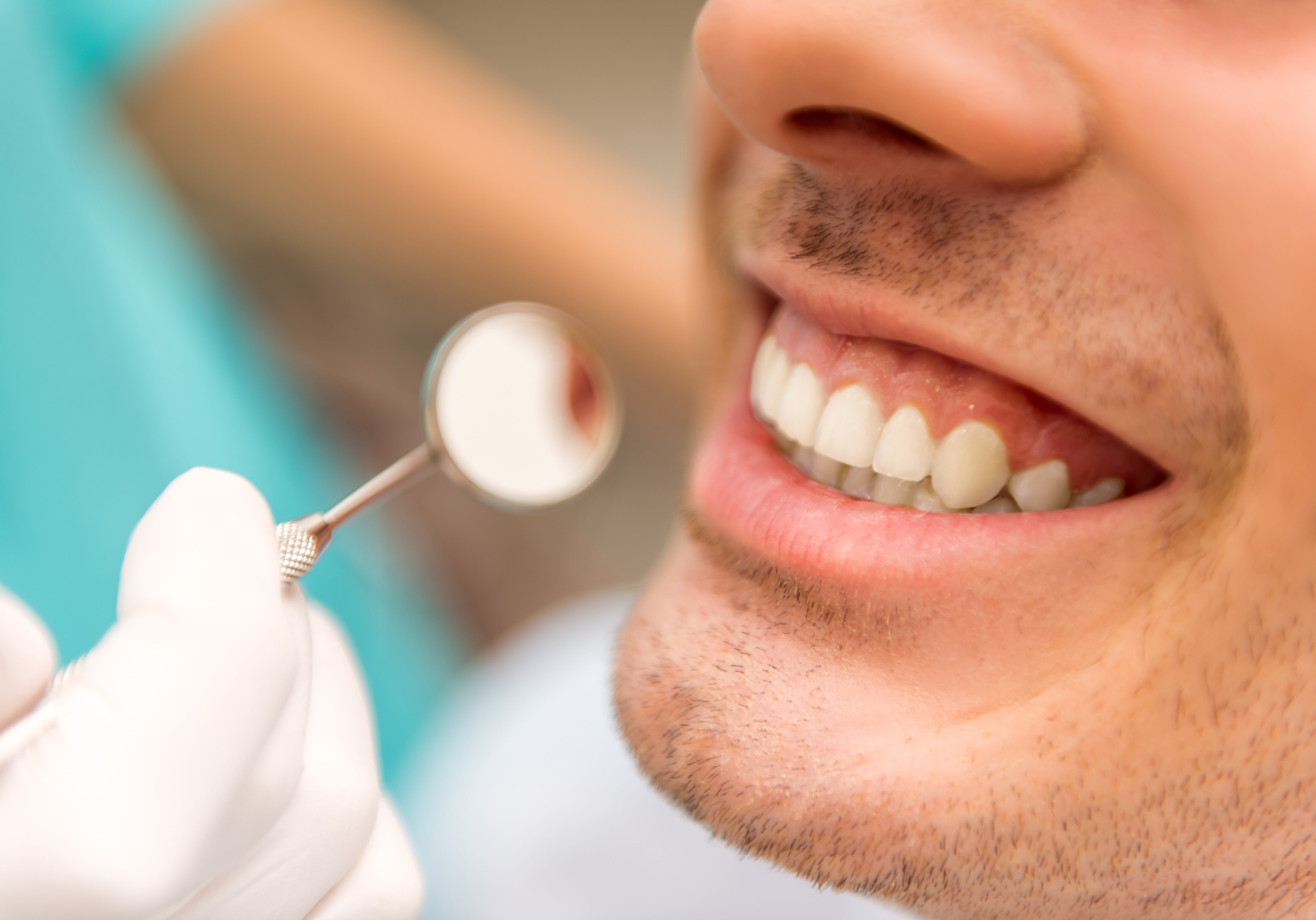 whitening whitening