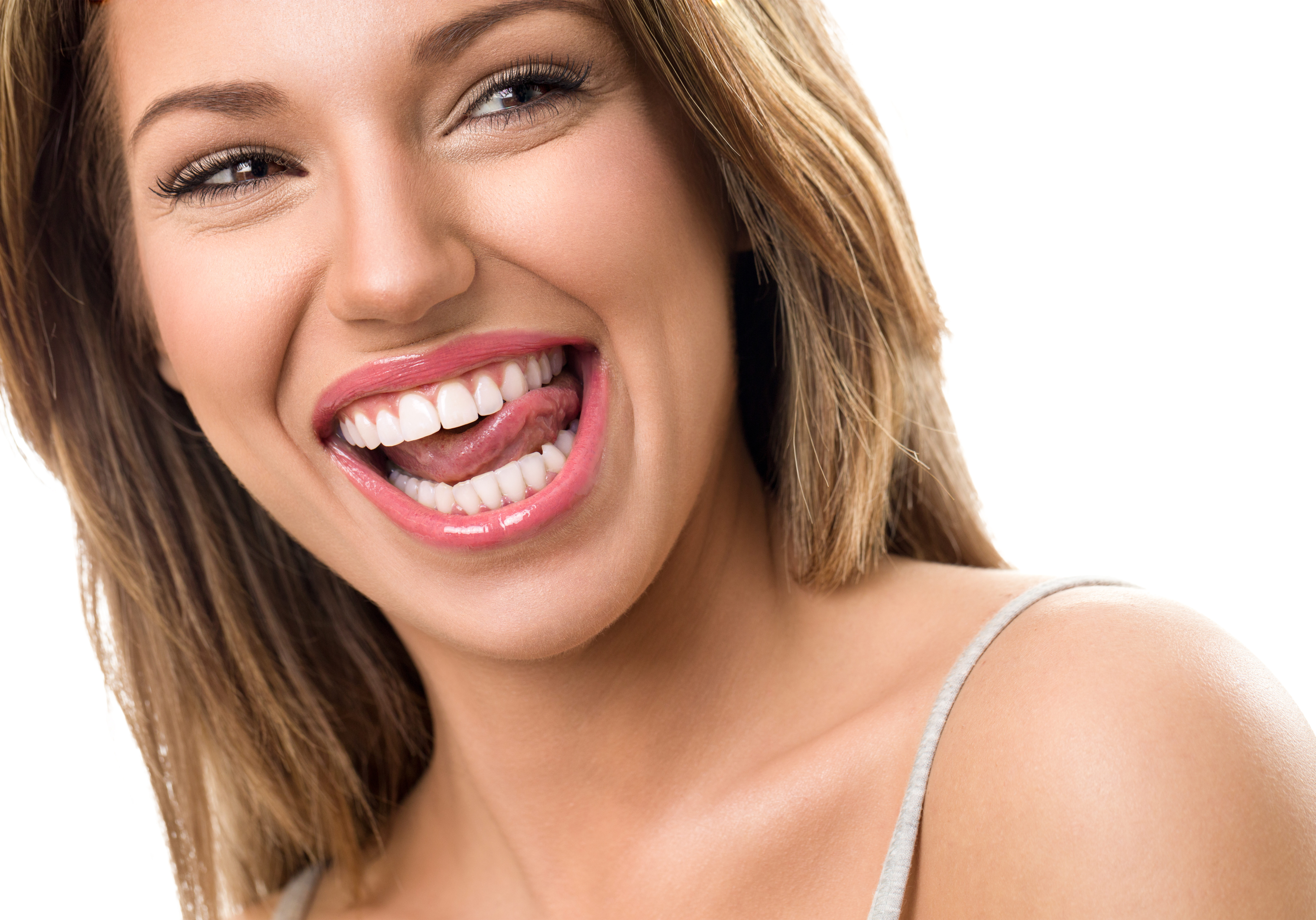 invisalign